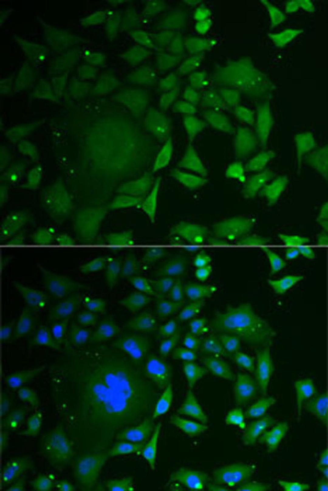 Immunofluorescence - C1D antibody (A6448)