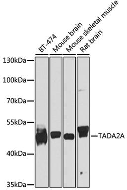 Western blot - TADA2A antibody (A8457)