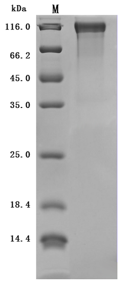 (Tris-Glycine gel) Discontinuous SDS-PAGE (reduced) with 5% enrichment gel and 15% separation gel.
