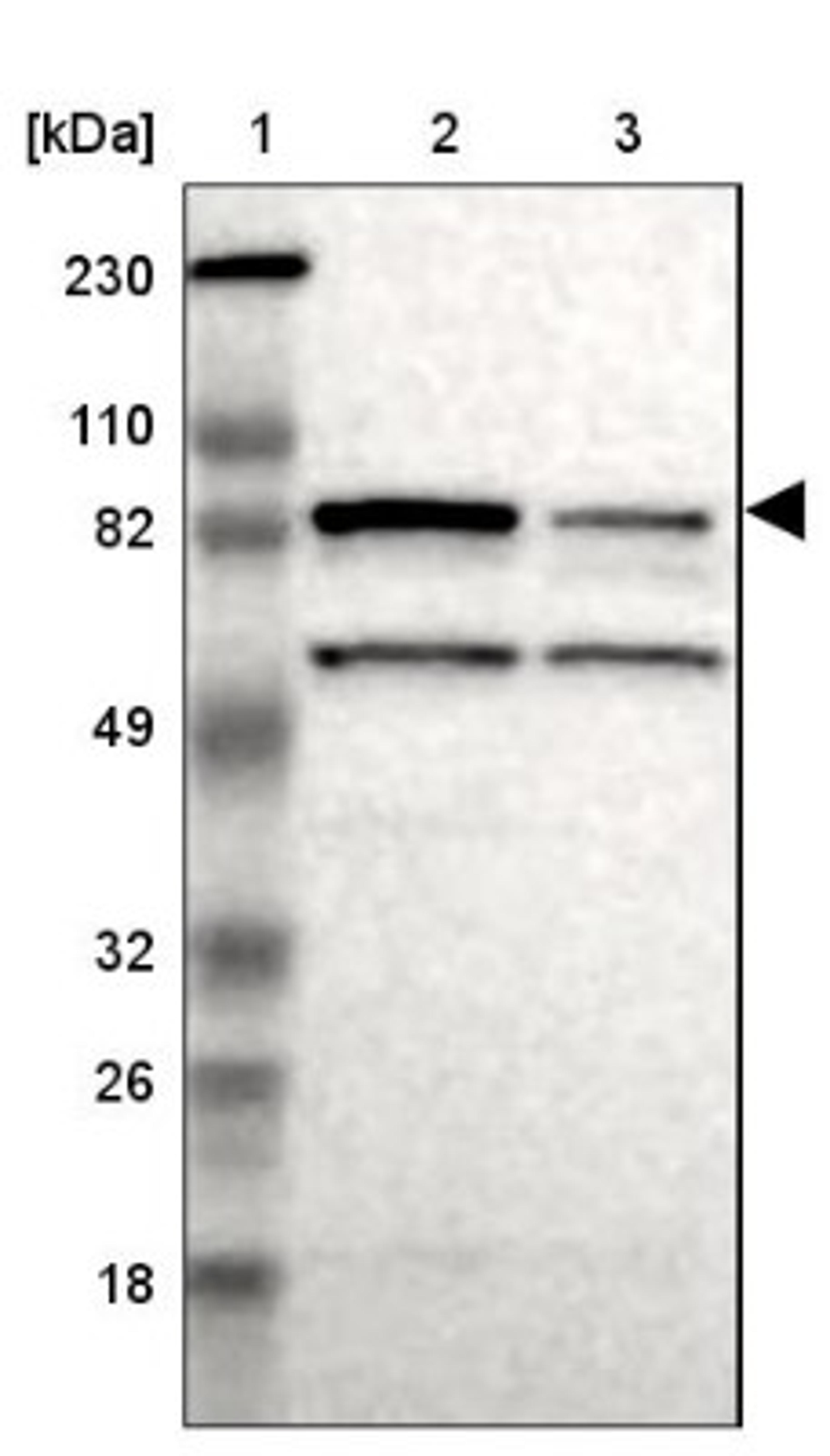 Western Blot: RSK4 Antibody [NBP1-87107] - Lane 1: Marker [kDa] 230, 110, 82, 49, 32, 26, 18<br/>Lane 2: Human cell line RT-4<br/>Lane 3: Human cell line U-251MG sp