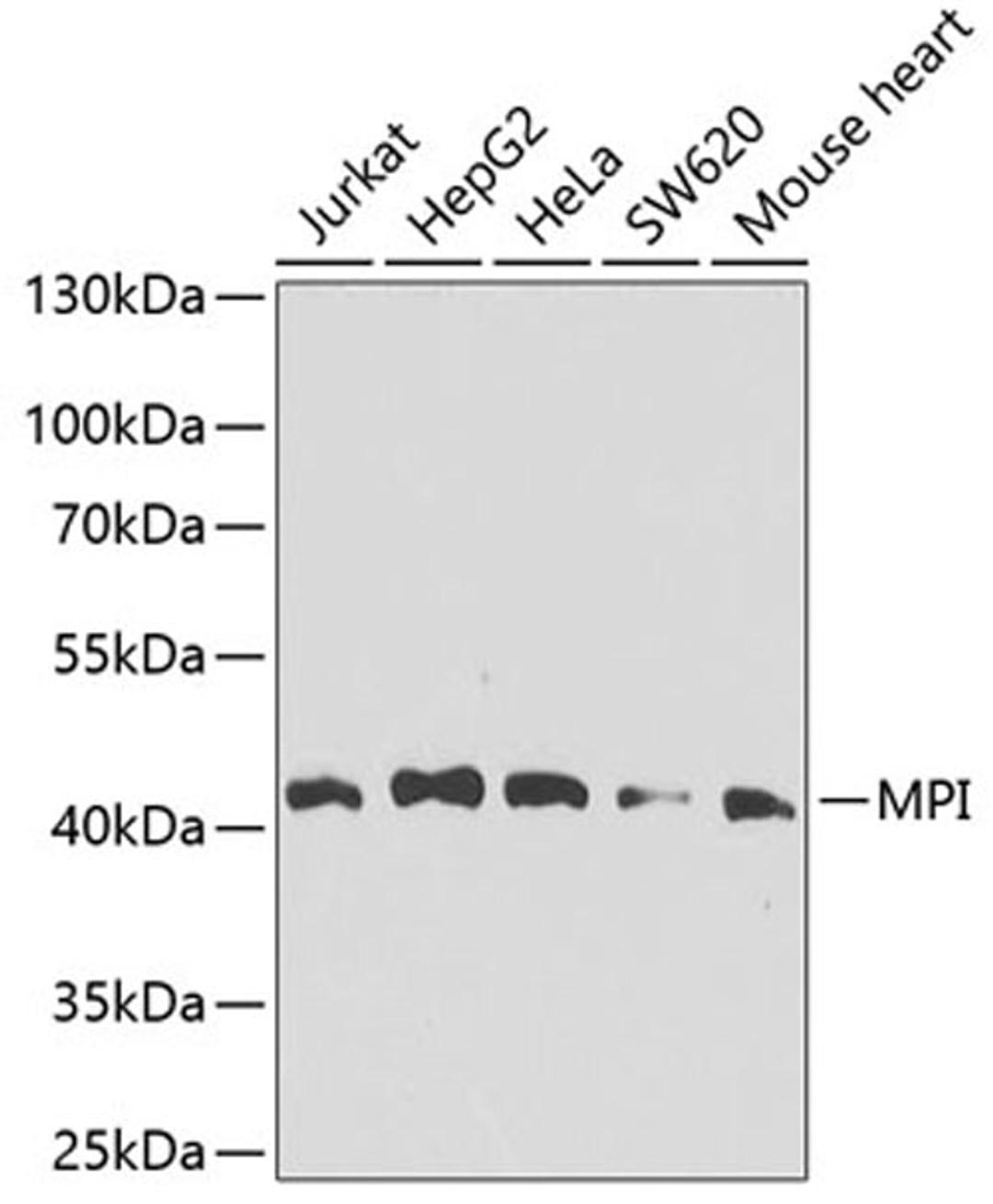 Western blot - MPI antibody (A7319)