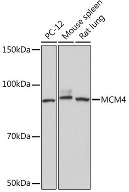 Western blot - MCM4 Rabbit mAb (A9251)