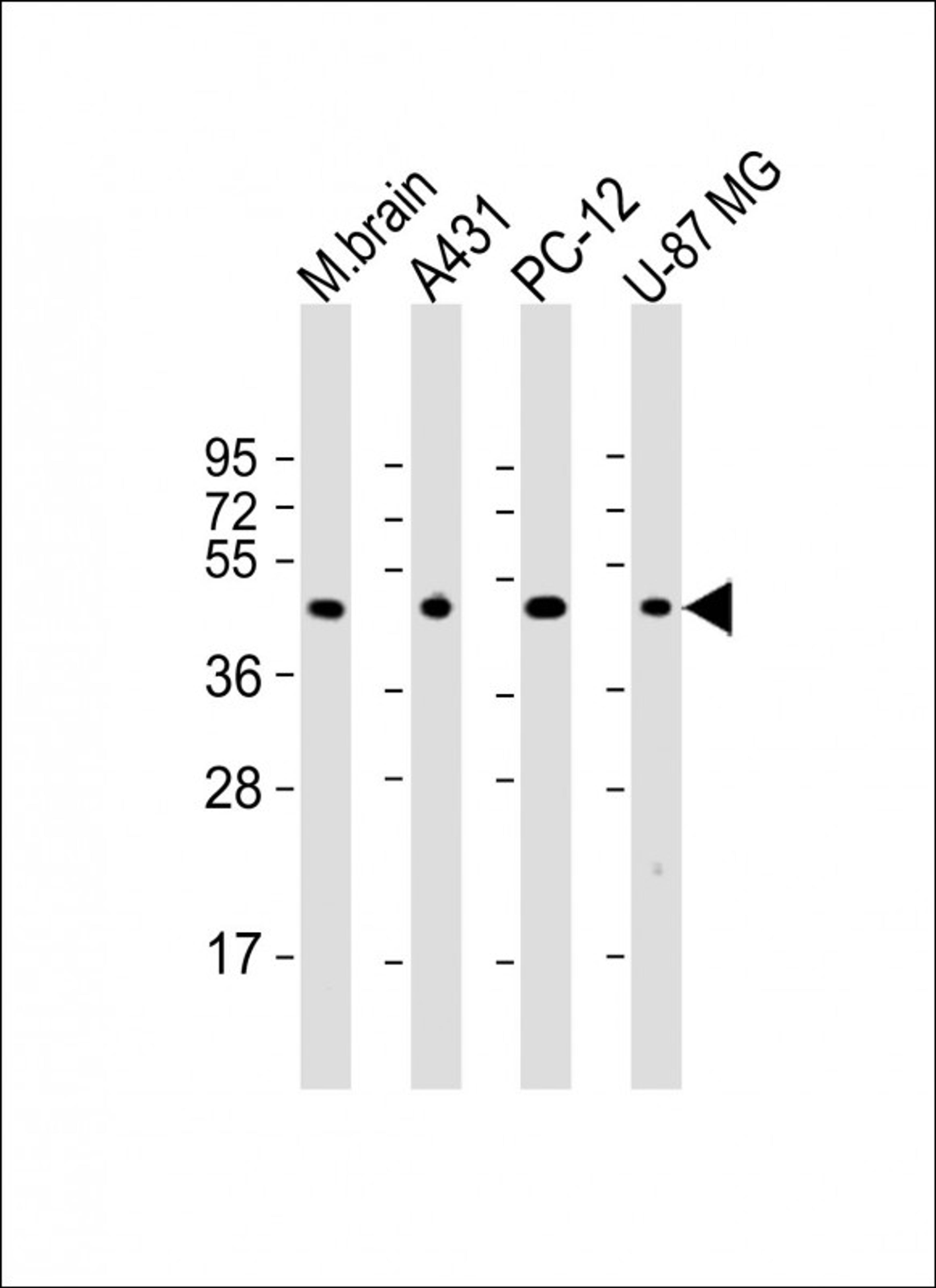 Western Blot at 1:2000 dilution Lane 1: mouse brain lysate Lane 2: A431 whole cell lysate Lane 3: PC-12 whole cell lysate Lane 4: U-87 MG whole cell lysate Lysates/proteins at 20 ug per lane.