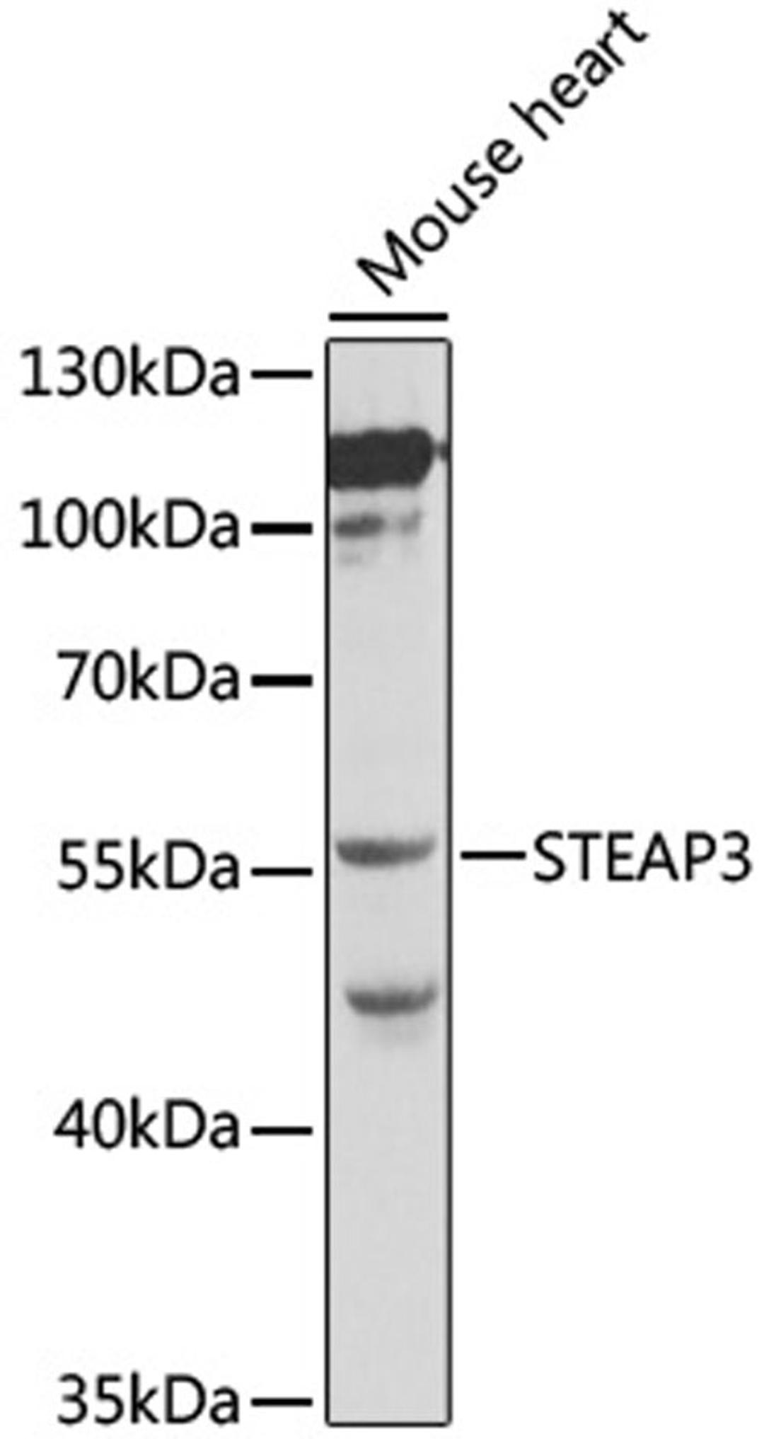 Western blot - STEAP3 antibody (A0683)