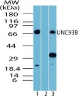 Western Blot: UNC93B Antibody [NBP2-24743] - Analysis of UNC93B in human spleen lysate in the 1) absence and 2) presence of immunizing peptide, and 3) mouse spleen lysate, using this antibody.