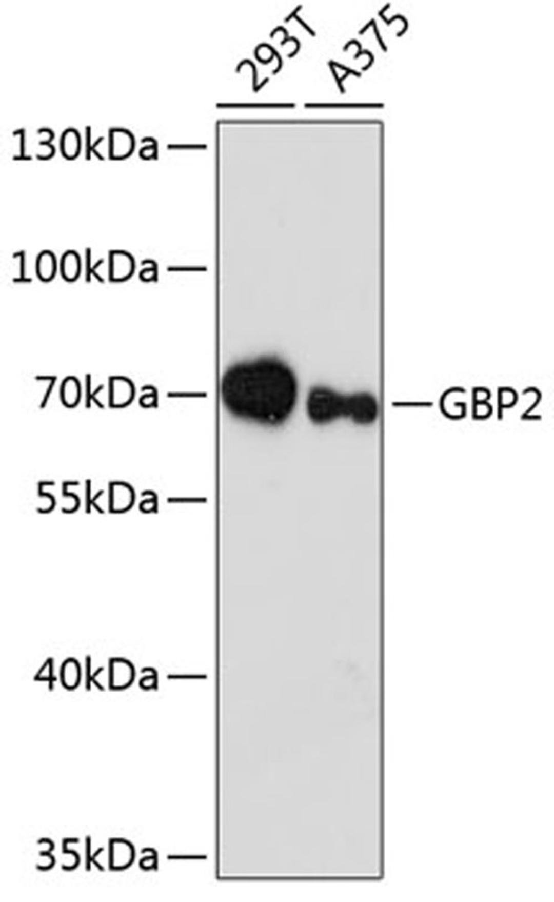 Western blot - GBP2 antibody (A12994)