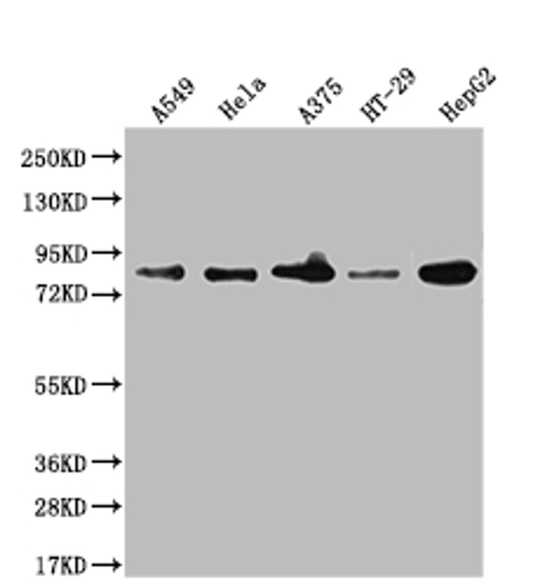 Western Blot. Positive WB detected in: A549 whole cell lysate, Hela whole cell lysate, A375 whole cell lysate, HT-29 whole cell lysate, HepG2 whole cell lysate, U-87 whole cell lysate. All lanes: Furin antibody at 1:1000. Secondary. Goat polyclonal to rabbit IgG at 1/50000 dilution. Predicted band size: 87 kDa. Observed band size: 87, 72 kDa. 