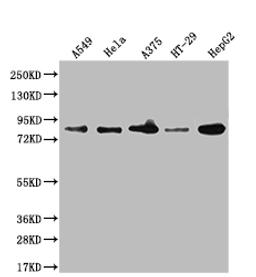 Western Blot. Positive WB detected in: A549 whole cell lysate, Hela whole cell lysate, A375 whole cell lysate, HT-29 whole cell lysate, HepG2 whole cell lysate, U-87 whole cell lysate. All lanes: Furin antibody at 1:1000. Secondary. Goat polyclonal to rabbit IgG at 1/50000 dilution. Predicted band size: 87 kDa. Observed band size: 87, 72 kDa. 