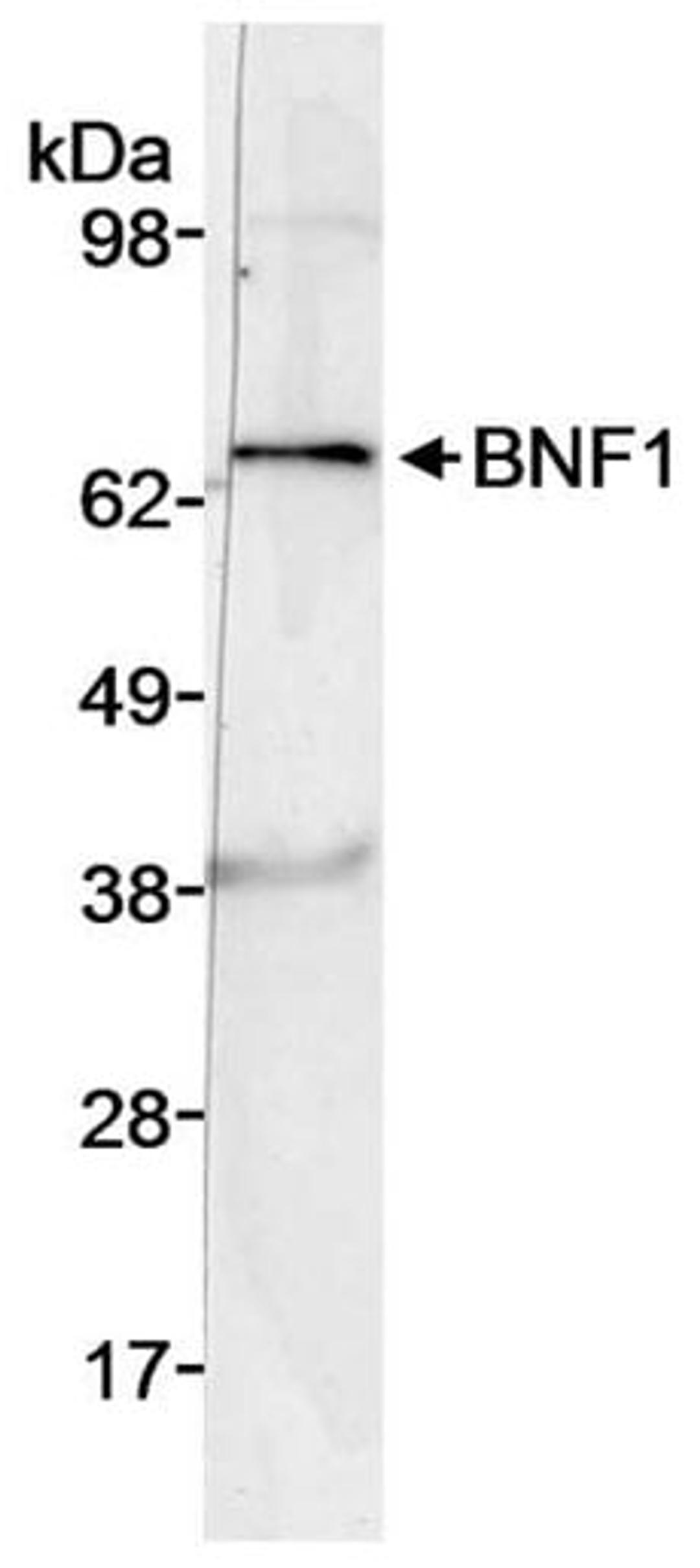 Detection of human BNF1 by western blot.