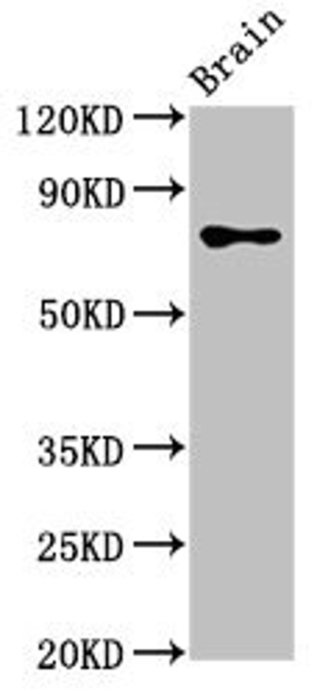 Western Blot. Positive WB detected in: Rat brain tissue. All lanes: CASC1 antibody at 3.4ug/ml. Secondary. Goat polyclonal to rabbit IgG at 1/50000 dilution. Predicted band size: 84, 79, 82, 76 kDa. Observed band size: 84 kDa. 
