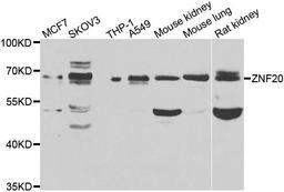 Western blot analysis of extracts of various cell lines using ZNF20 antibody