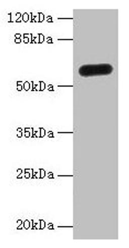 Western Blot. All lanes: C8orf34 antibody at 5µg/ml + Mouse skeletal muscle tissue. Secondary. Goat polyclonal to rabbit IgG at 1/10000 dilution. Predicted band size: 60, 48, 33, 23 kDa. Observed band size: 60 kDa
