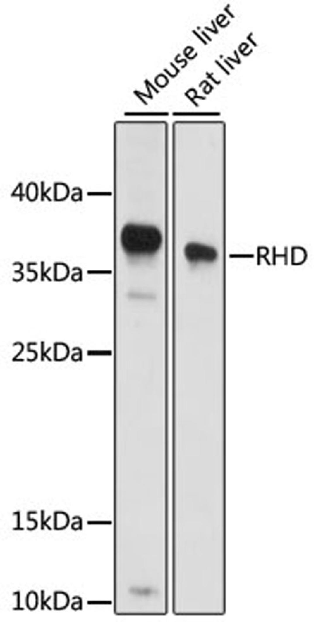 Western blot - RHD antibody (A15092)