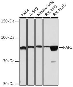 Western blot - PAF1 Rabbit mAb (A3437)