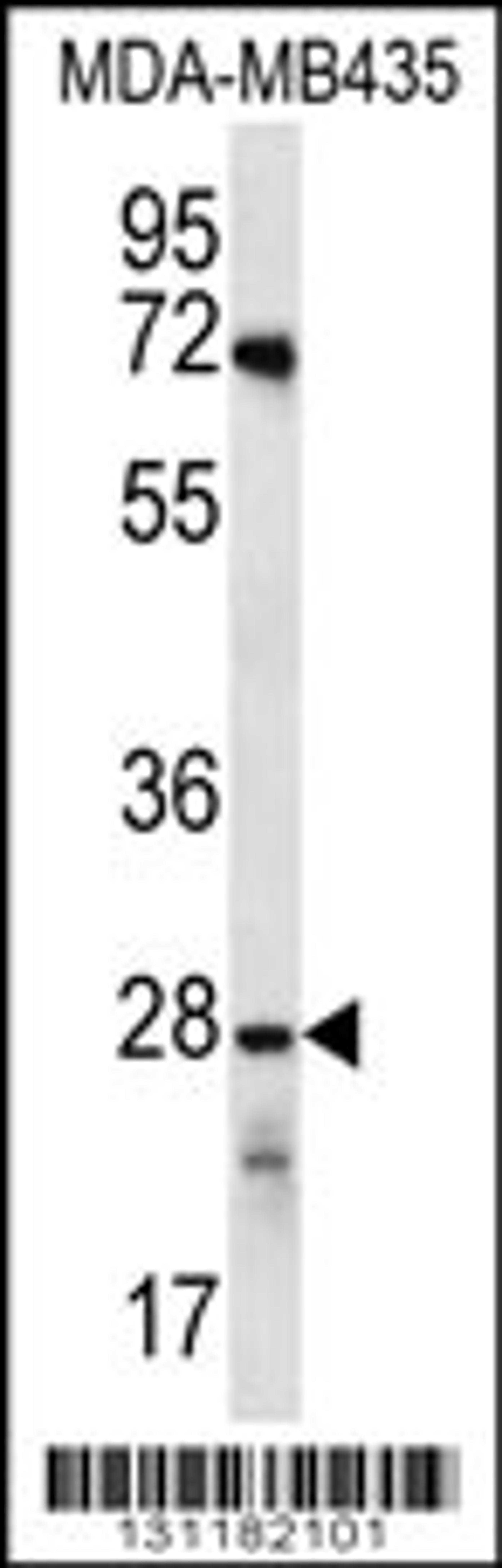 Western blot analysis in MDA-MB435 cell line lysates (35ug/lane).