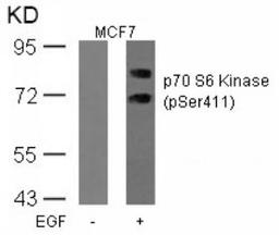 Western blot analysis of lysed extracts from MCF cells untreated or treated with EGF using p70 S6 Kinase (Phospho-Ser411).