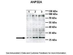 Antibody used in WB on Mouse cortex brain at: 1:1000 (Lane1: 10ug mouse cortex brain lysate, Lane2: 25ug mouse cortex brain lysate, Lane3: 40ug mouse cortex brain lysate).