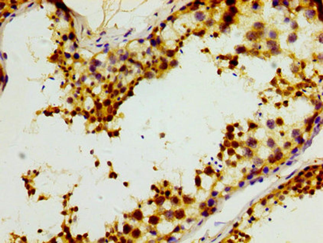 IHC image of CSB-PA011904LA01HU diluted at 1:400 and staining in paraffin-embedded human testis tissue performed on a Leica BondTM system. After dewaxing and hydration, antigen retrieval was mediated by high pressure in a citrate buffer (pH 6.0). Section was blocked with 10% normal goat serum 30min at RT. Then primary antibody (1% BSA) was incubated at 4°C overnight. The primary is detected by a biotinylated secondary antibody and visualized using an HRP conjugated SP system.