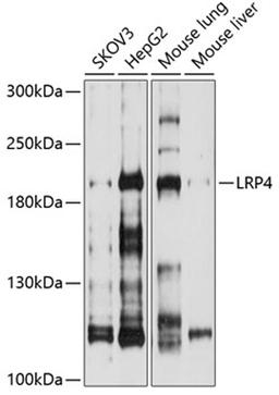 Western blot - LRP4 antibody (A10172)