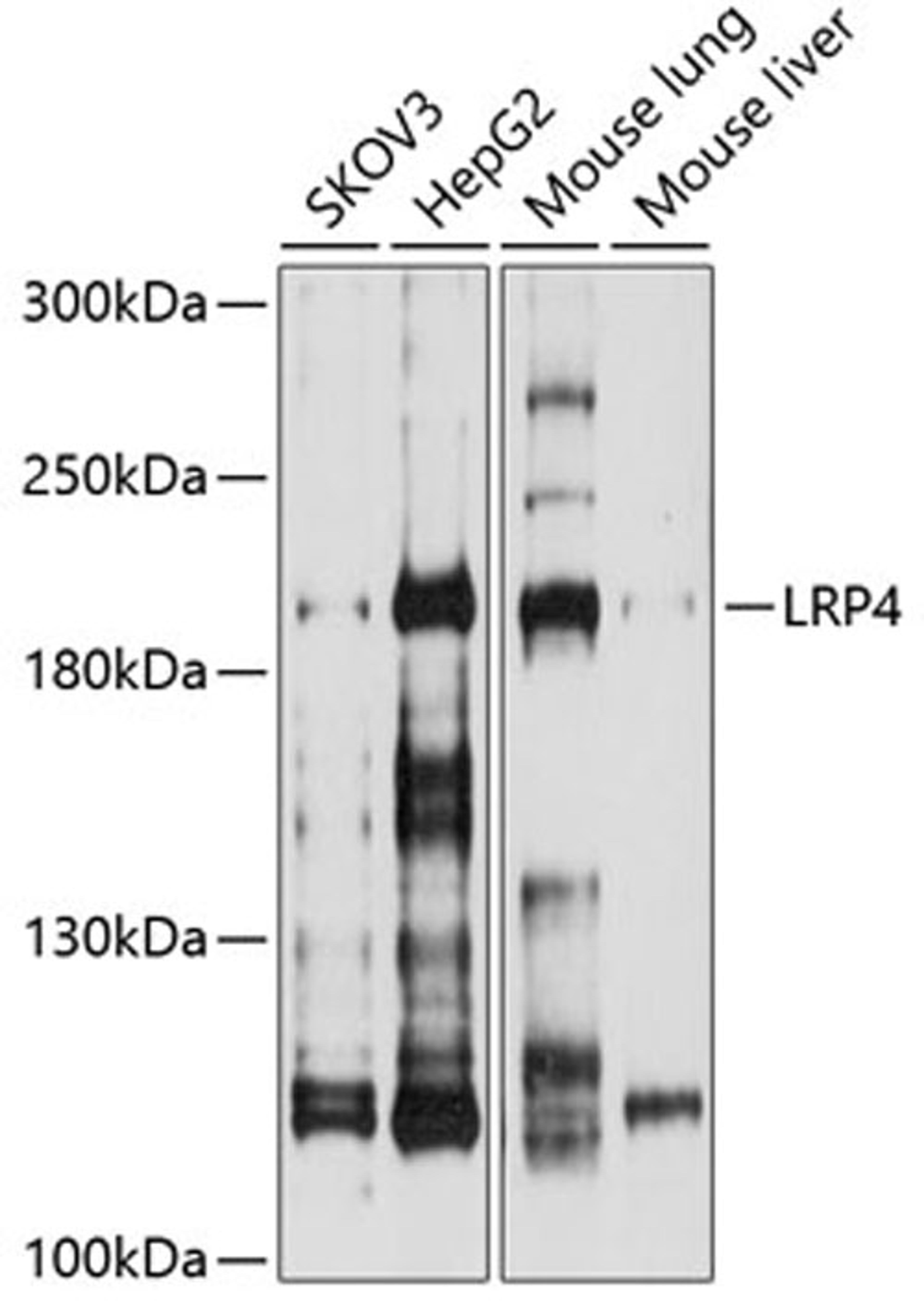 Western blot - LRP4 antibody (A10172)