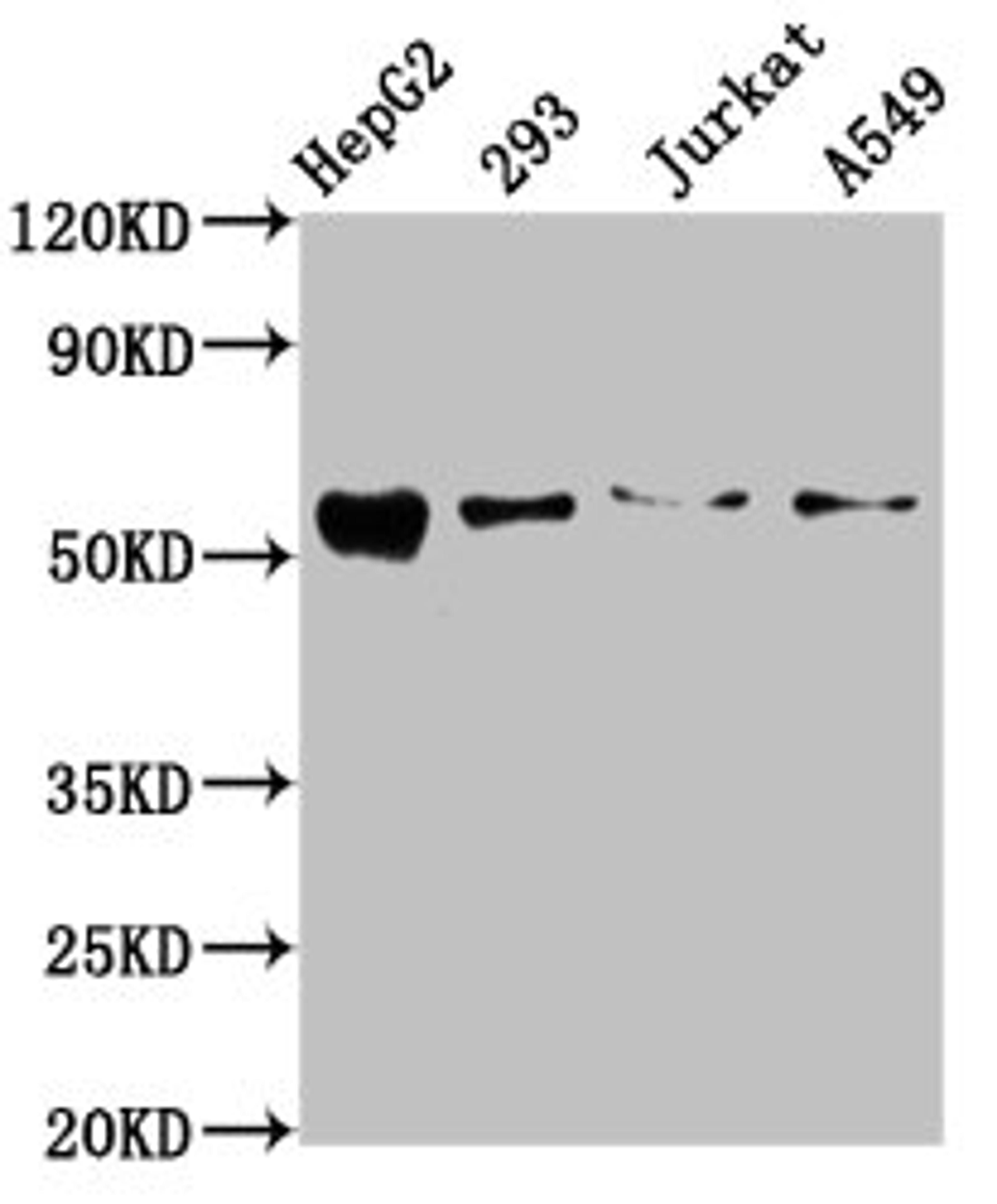 Western Blot. Positive WB detected in: HepG2 whole cell lysate, 293 whole cell lysate, Jurkat whole cell lysate, A549 whole cell lysate. All lanes: ZDHHC14 antibody at 10.5µg/ml. Secondary. Goat polyclonal to rabbit IgG at 1/50000 dilution. Predicted band size: 54, 52 kDa. Observed band size: 54 kDa
