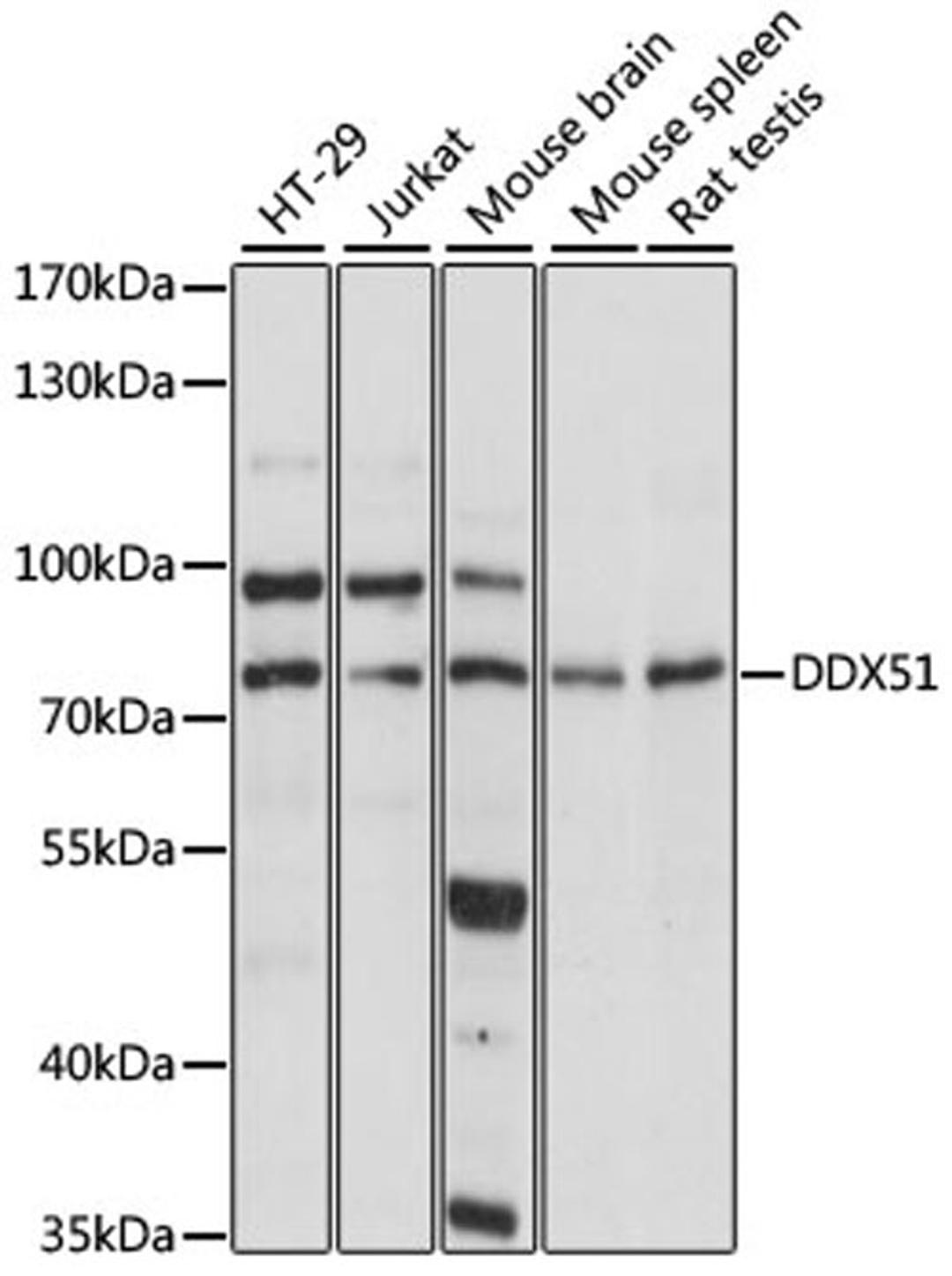 Western blot - DDX51 antibody (A15580)