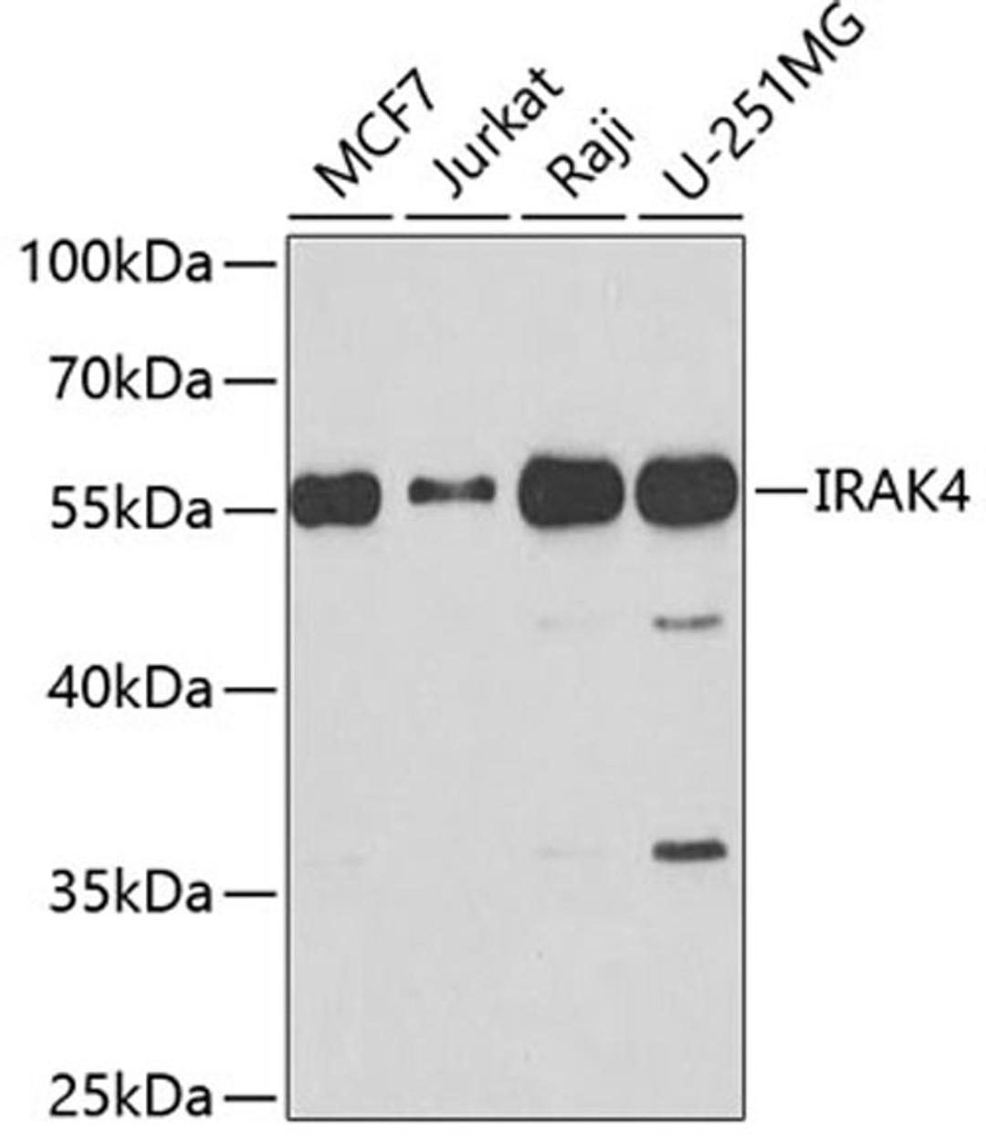 Western blot - IRAK4 antibody (A6208)