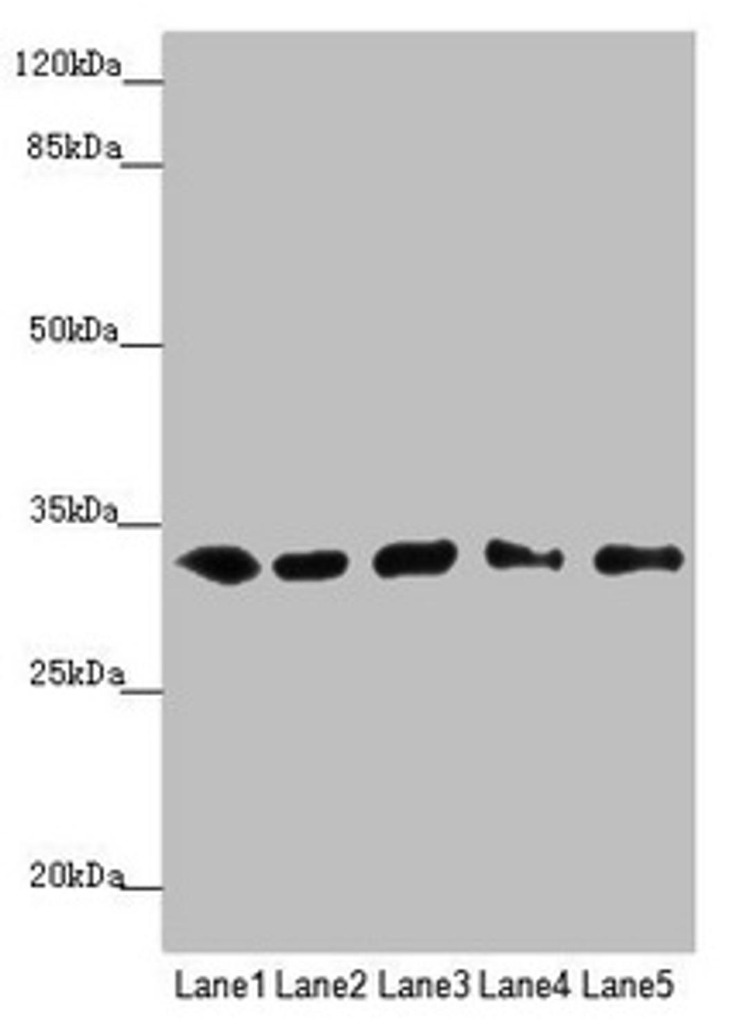 Western blot. All lanes: MMACHC antibody at 5.16µg/ml. Lane 1: HepG2 whole cell lysate. Lane 2: K562 whole cell lysate. Lane 3: A549 whole cell lysate. Lane 4: Hela whole cell lysate. Lane 5: Raji whole cell lysate. Secondary. Goat polyclonal to rabbit IgG at 1/10000 dilution. Predicted band size: 32 kDa. Observed band size: 32 kDa