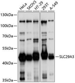 Western blot - SLC29A3 antibody (A10377)