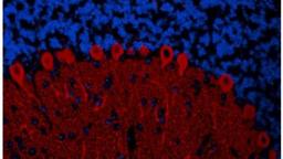 Immunocytochemistry/Immunofluorescence: IP3R1 Antibody [NBP1-21398] - Mouse cerebellum  used at a dilution of 1:100 (2ug/ml).