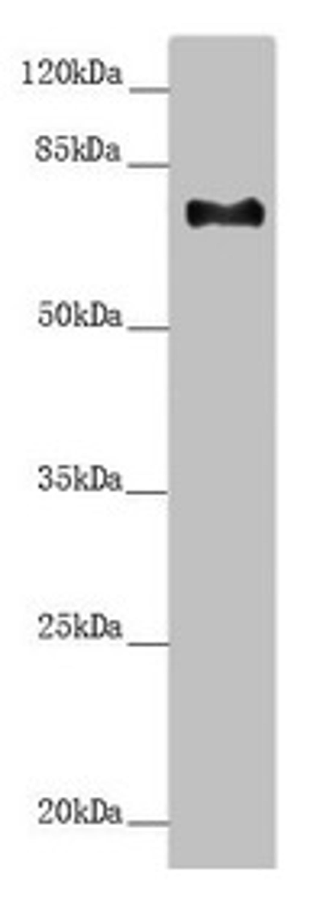 Western blot. All lanes: CEP72 antibody at 3.37µg/ml + Hela whole cell lysate. Secondary. Goat polyclonal to rabbit IgG at 1/10000 dilution. Predicted band size: 72, 22 kDa. Observed band size: 72 kDa