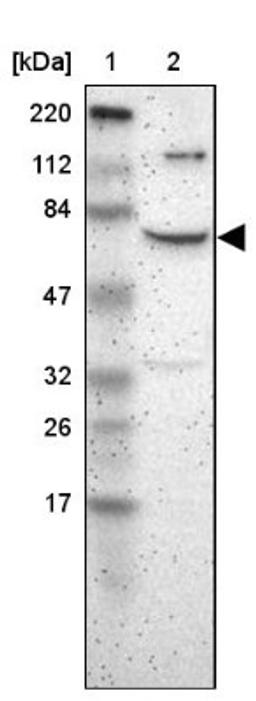 Western Blot: ZNF192 Antibody [NBP1-82840] - Lane 1: Marker [kDa] 220, 112, 84, 47, 32, 26, 17<br/>Lane 2: Human cell line RT-4