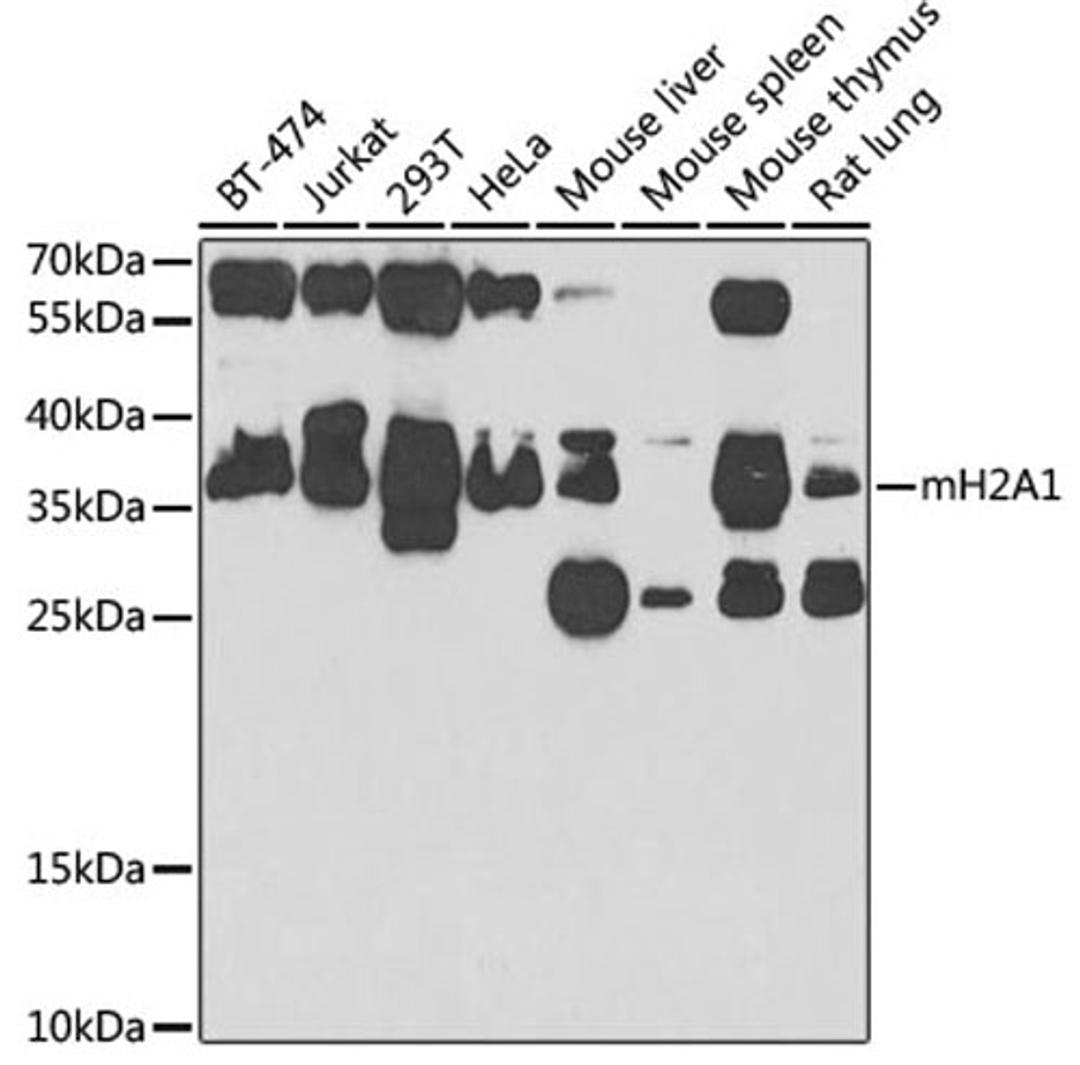 Western blot - H2AFY antibody (A7045)