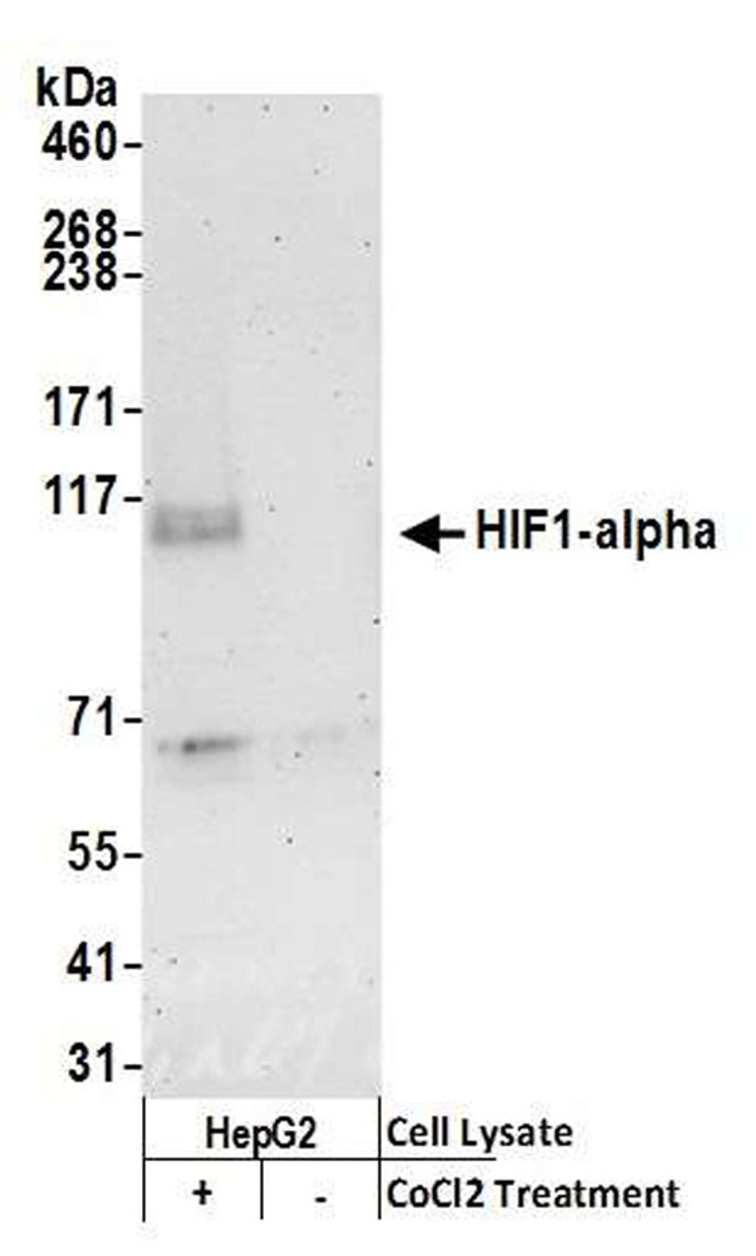 Detection of human HIF1-alpha by WB.