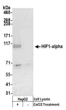 Detection of human HIF1-alpha by WB.