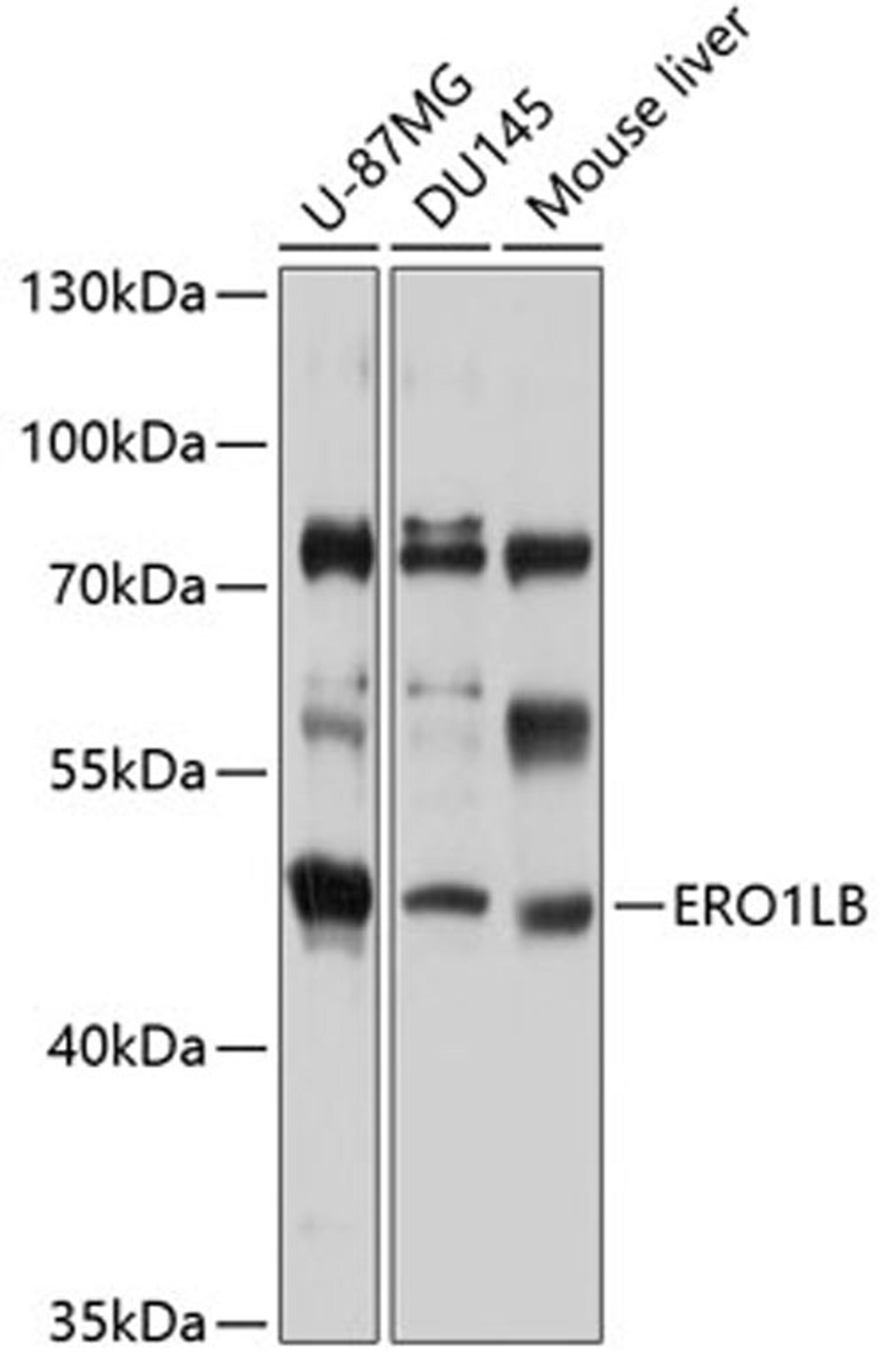 Western blot - ERO1LB antibody (A3682)