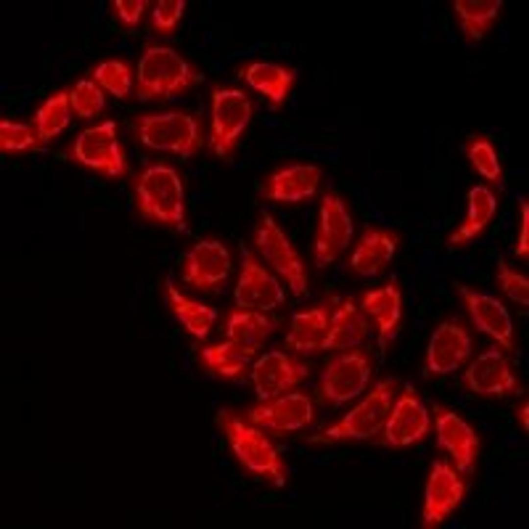 Immunofluorescent analysis of HeLa cells using TBXAS1 antibody