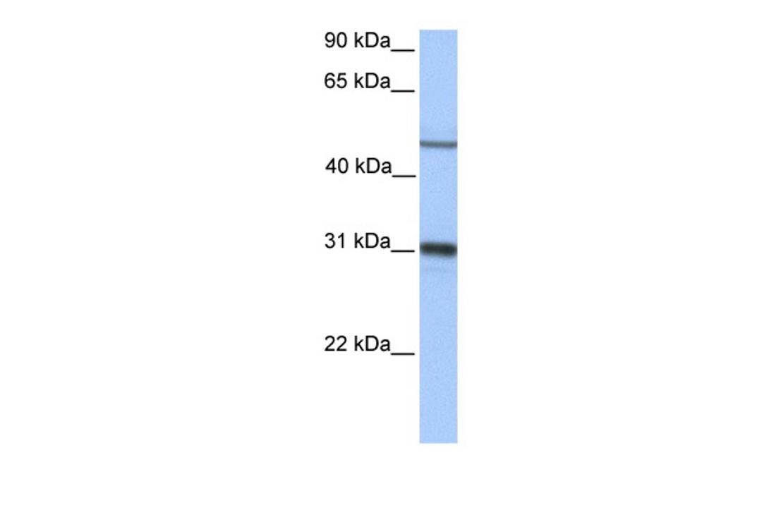 Antibody used in WB on Human Liver at 0.2-1 ug/ml.