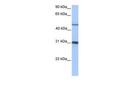 Antibody used in WB on Human Liver at 0.2-1 ug/ml.