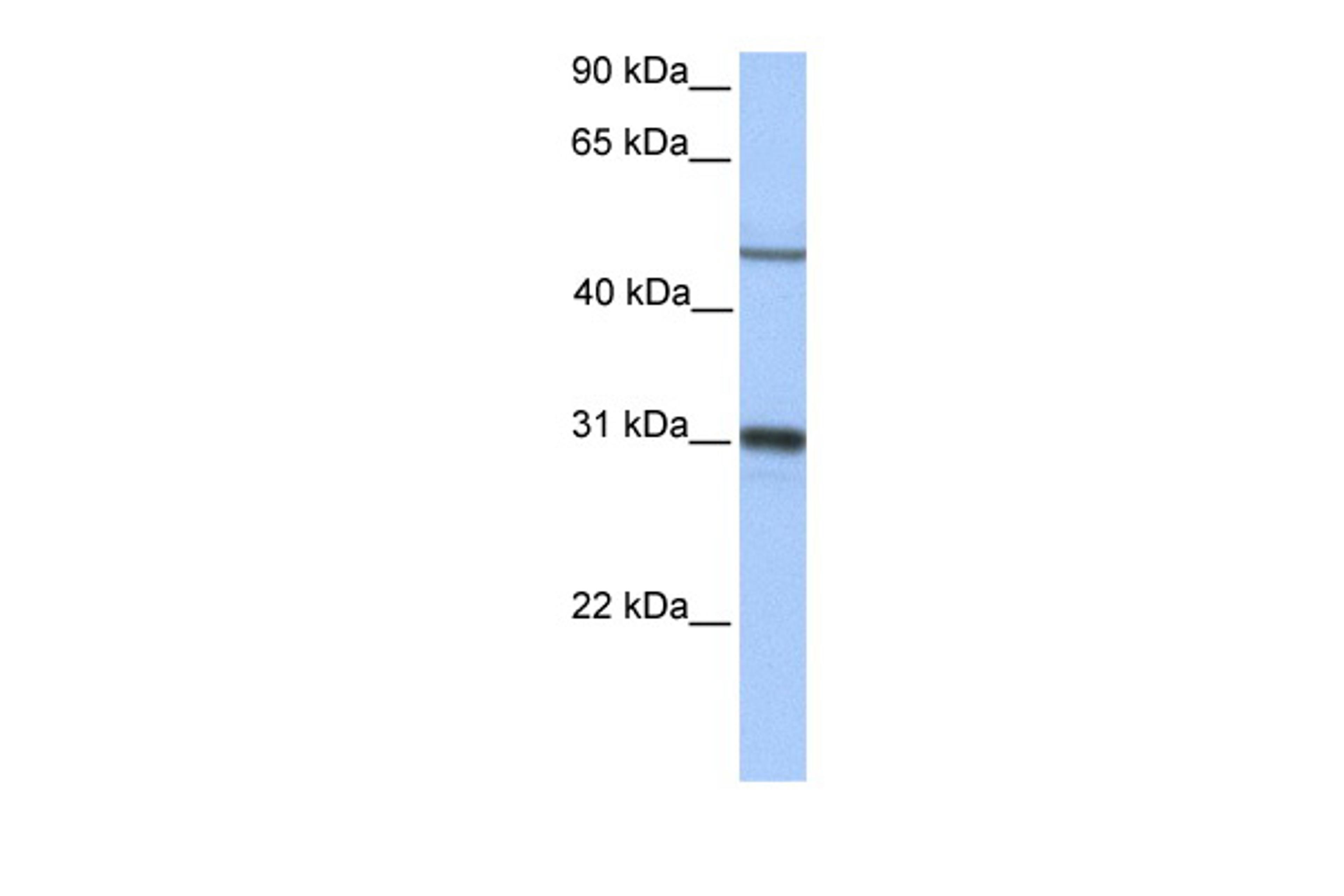 Antibody used in WB on Human Liver at 0.2-1 ug/ml.