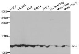 Western blot analysis of extracts of various cell lines using MGP antibody