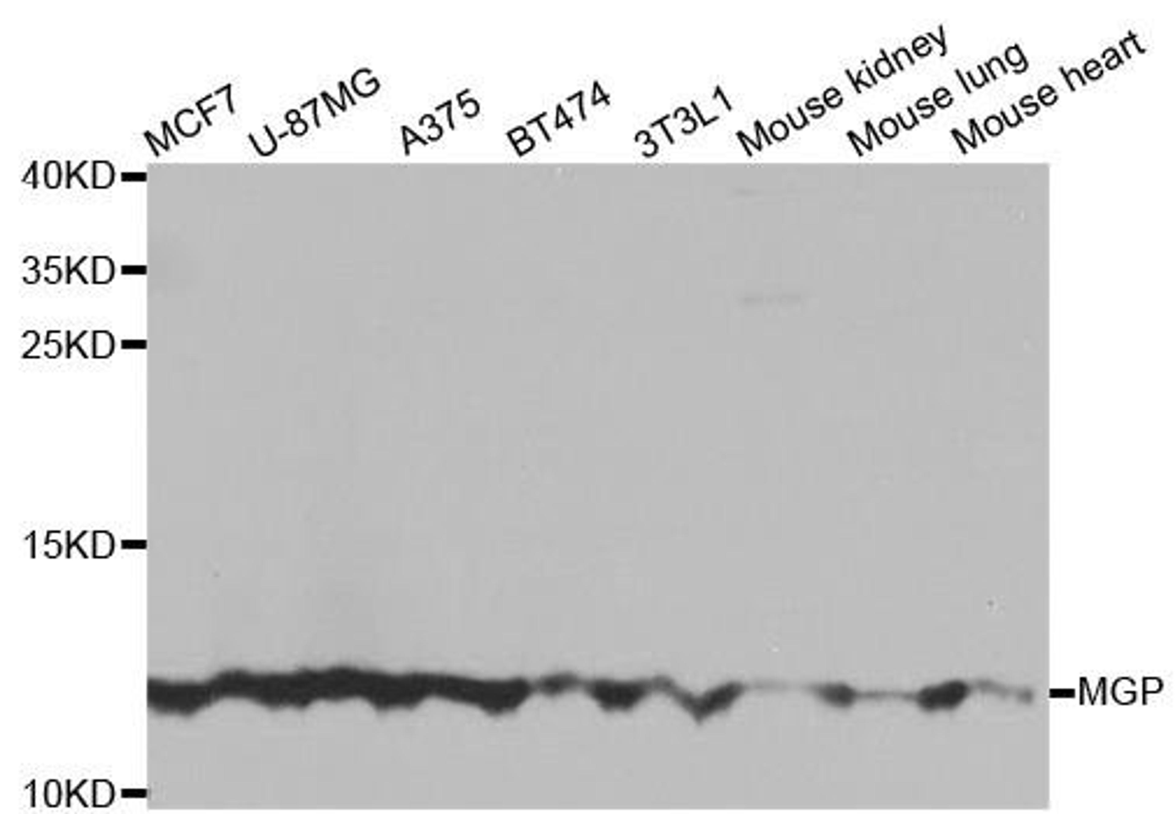 Western blot analysis of extracts of various cell lines using MGP antibody