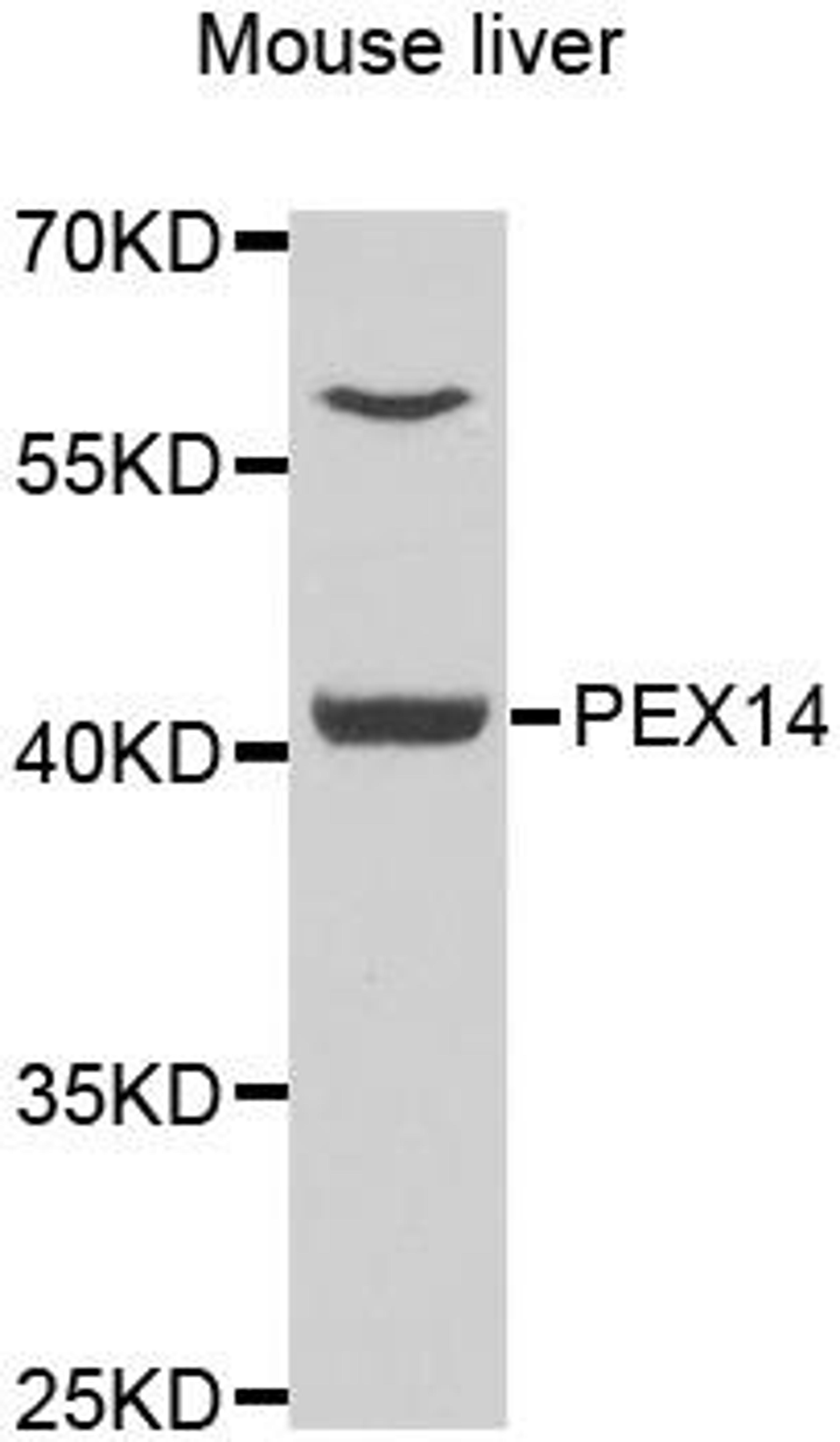 Western blot analysis of extracts of mouse liver using PEX3 antibody