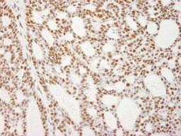 Detection of human RecQ1 by immunohistochemistry.