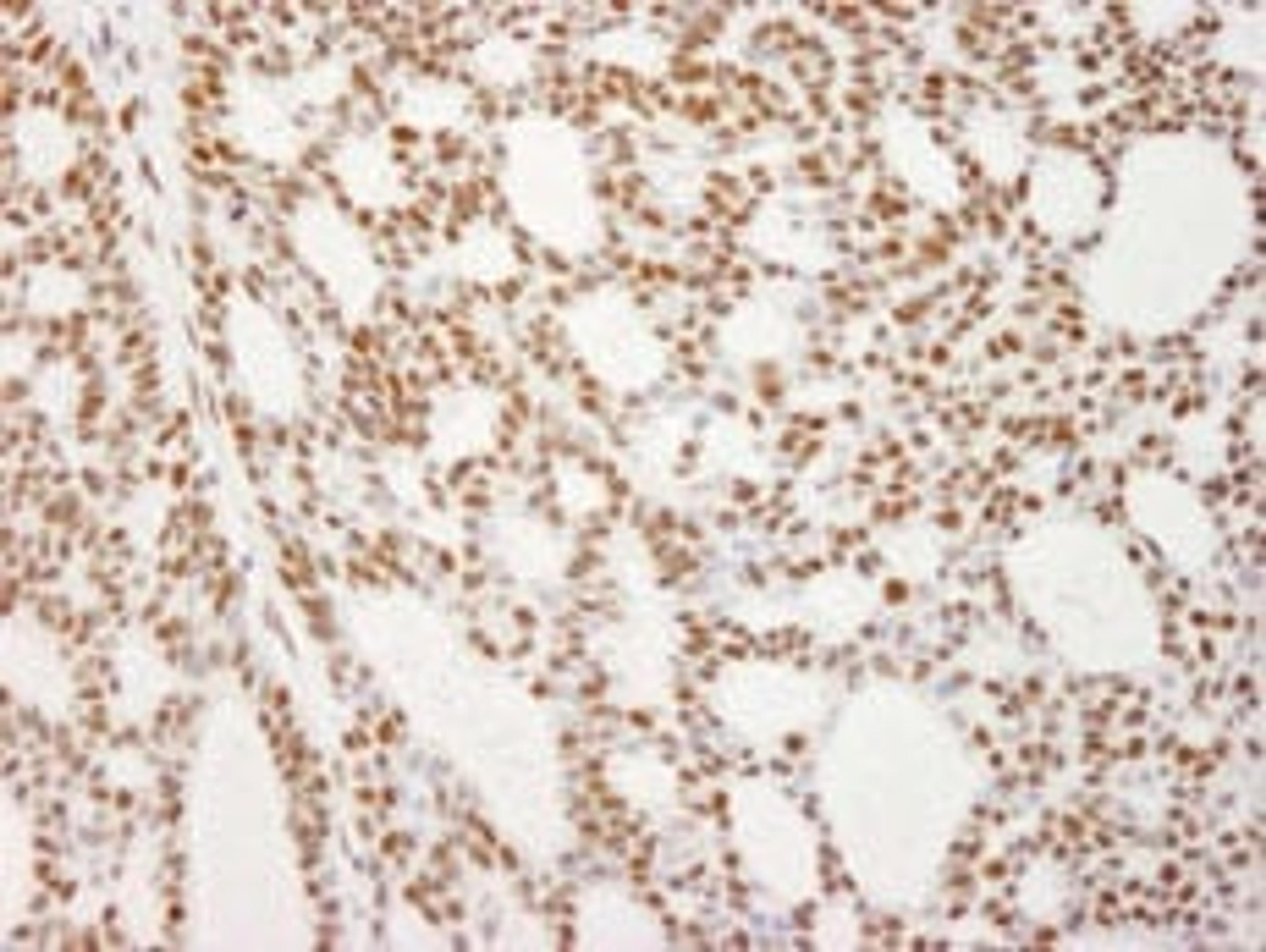 Detection of human RecQ1 by immunohistochemistry.