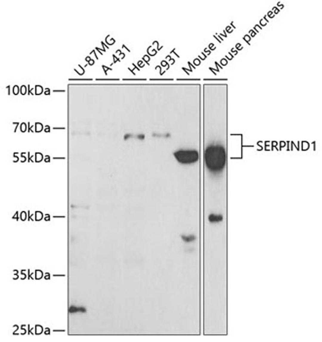 Western blot - SERPIND1 antibody (A5848)