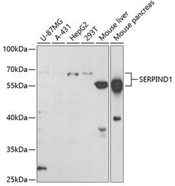 Western blot - SERPIND1 antibody (A5848)