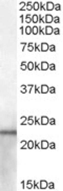 45-839 (2ug/ml) staining of Mouse Kidney lysate (35ug protein in RIPA buffer). Primary incubation was 1 hour. Detected by chemiluminescence.