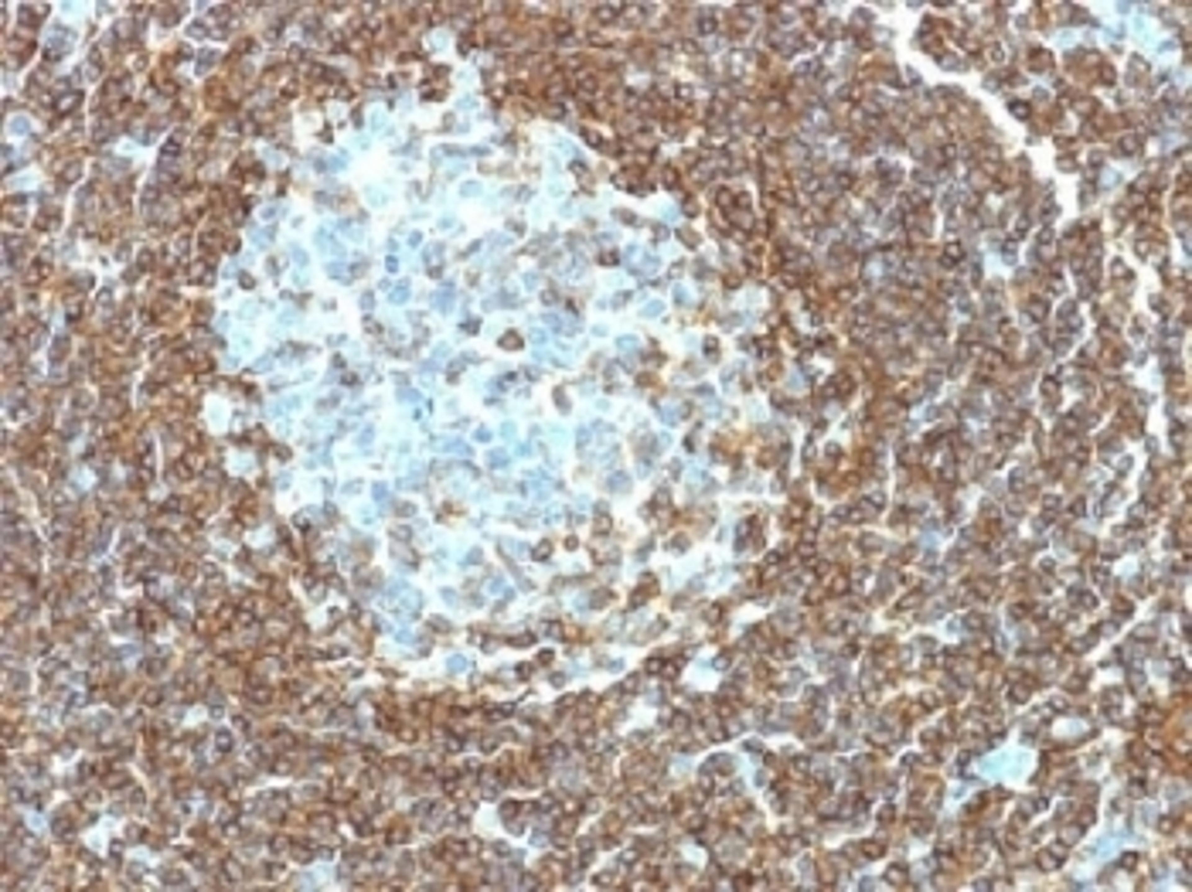 IHC testing of human tonsil tissue with CD3e antibody (clone C3e/1308). Required HIER: boil tissue sections in 10mM citrate buffer, pH 6.0, for 10-20 min.