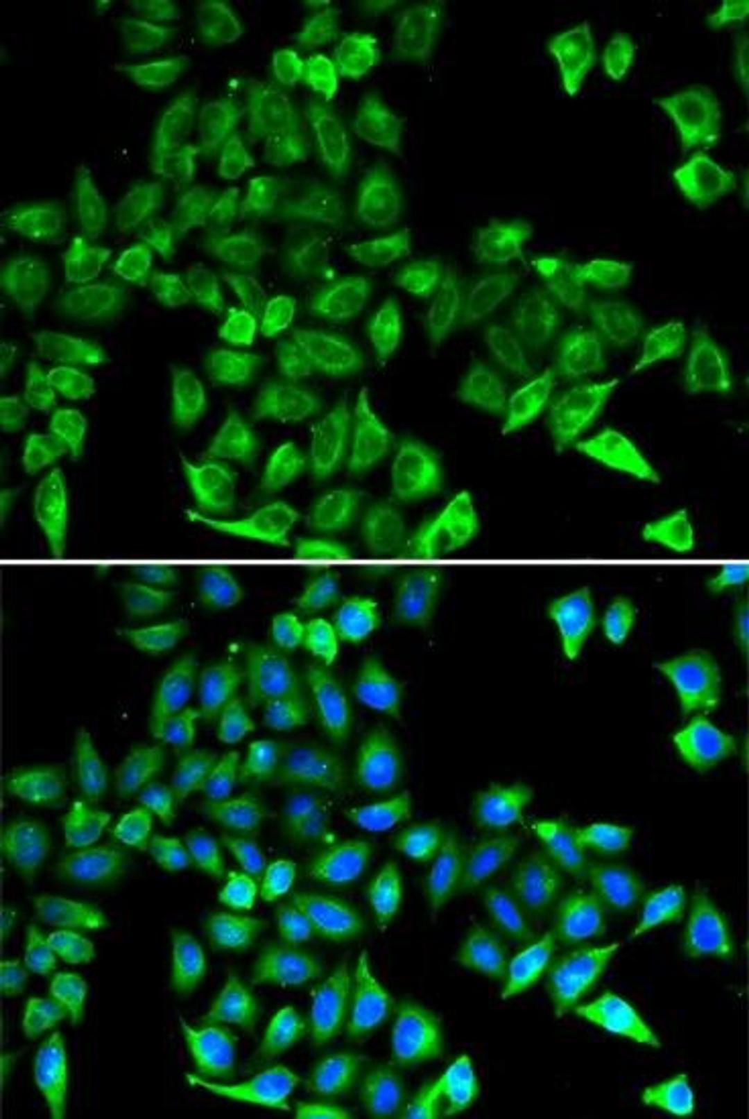 Immunofluorescence analysis of HeLa cell using Cystatin C antibody